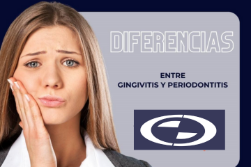 Diferencias entre Gingivitis y Periodontitis - Clínica dental en Sevilla