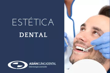 Carillas dentales: la solución perfecta para una sonrisa perfecta - Clínica dental en Sevilla