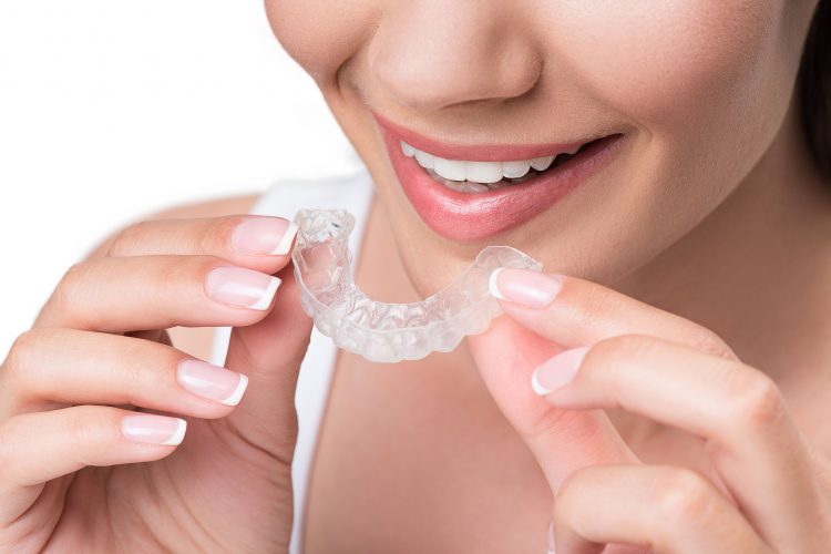 Estética Dental - Clínica dental en Sevilla