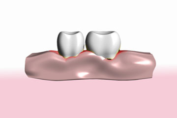 Periodoncia - Clínica dental en Sevilla