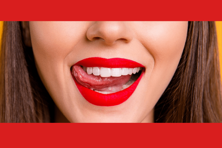 Claves del éxito de las carillas dentales - Clínica dental en Sevilla