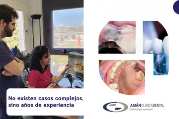 Casos complejos - Clínica dental en Sevilla