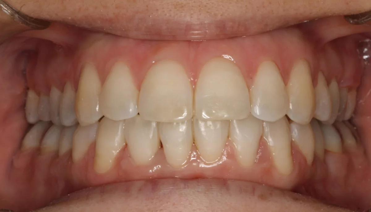 Ortodoncia - Clínica dental en Sevilla