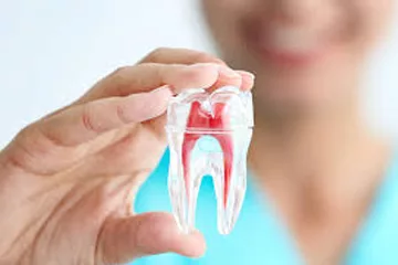 Endodoncia - Clínica dental en Sevilla
