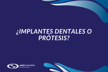 ¿Implantes dentales o prótesis? - Clínica dental en Sevilla