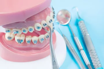 Ortodoncia y estética - Clínica dental en Sevilla