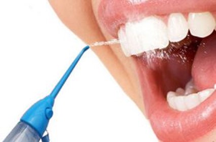 Irrigadores bucales, ¿Qué son? - Clínica dental en Sevilla